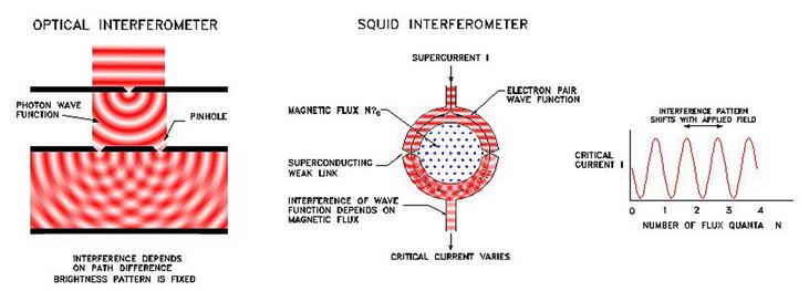SQUID Superconducting