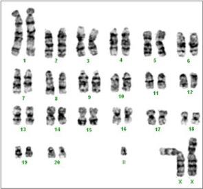 First let s look at chromosomes (Karyotype) Is this person a male