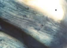 20 μm B 20 μm C B Fig. 5. Spores of the genus Glomus and arbuscular mycorrhizal structures in Cacao.
