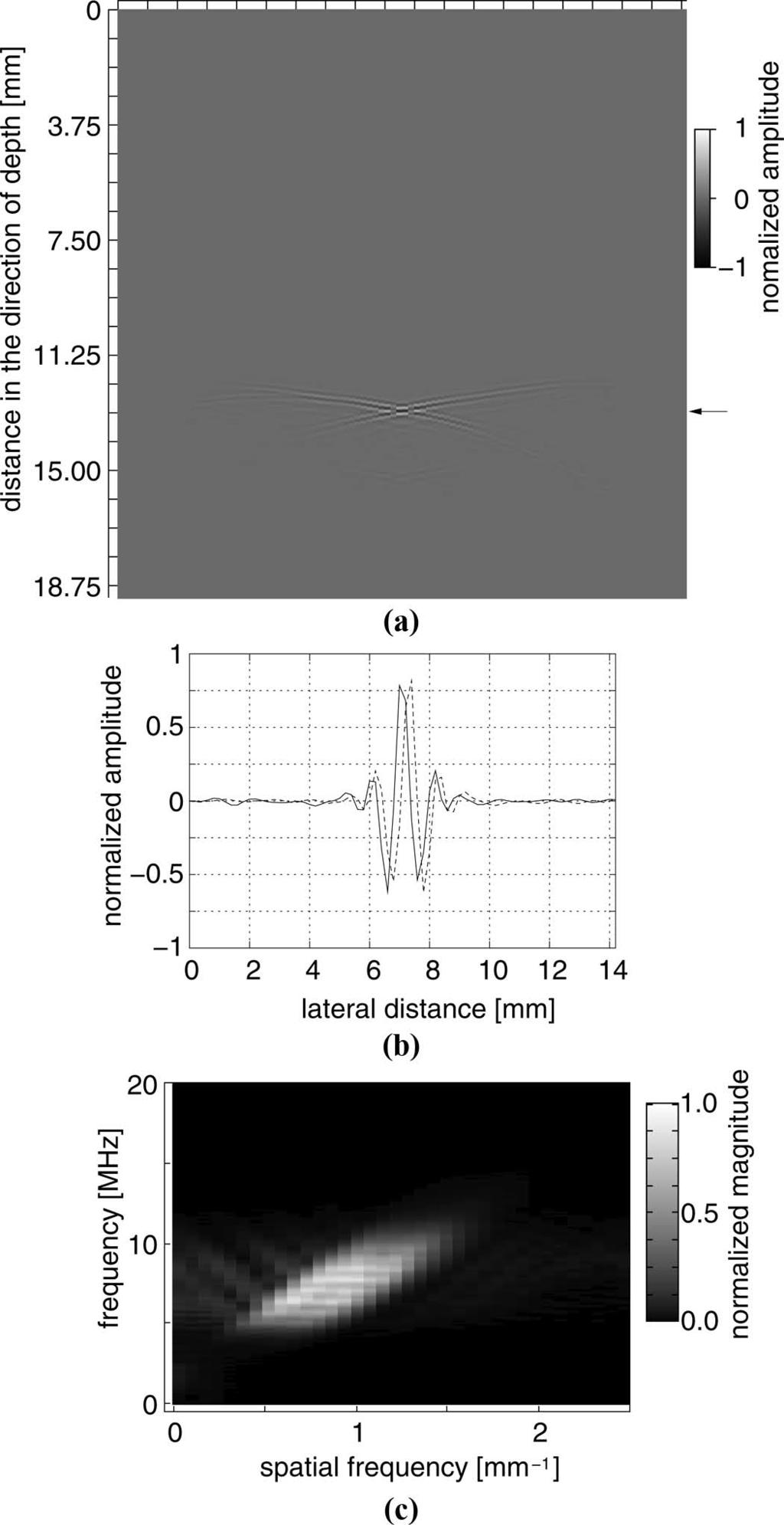 hasegawa and kanai: phase-sensitive lateral motion estimator phantom study 455 respectively. As shown in Fig.