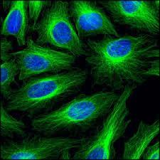 HeLa Cells Immortal cells do not die after a few divisions