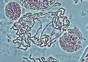 Meiosis I - Prophase Zygotene / pachyten