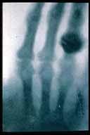 X rays On 8 November 1895, Wilhelm Conrad Roentgen (1845-1923) was experimenting on