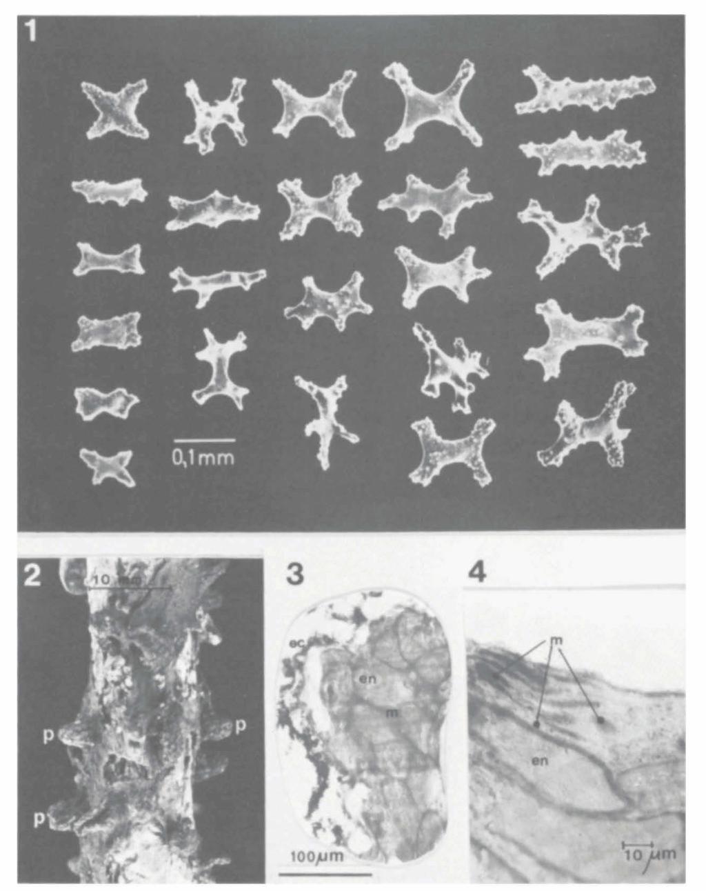 OCANA, BRITO & NUNEZ: A NEW SPECIES OF SARCODICTYON FROM TENERIFE 425 Figs. 1-4. Sarcodictyon canariensis spec. nov. (holotype, RMNH 18616). Fig. 1. Sclerites of stolons and anthosteles. Fig. 2.
