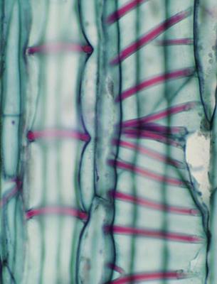 Xylem Xylem is a complex tissue that includes tracheary elements Tracheary elements are dead at maturity and have