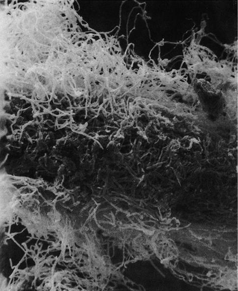 468 PAUL E. MARSHALL AND NANCY PATTULLO hyphal development in early fall (Fig. 1). Non-mycorrhizal root tips were most easily identified by use of the SEM at high magnification.