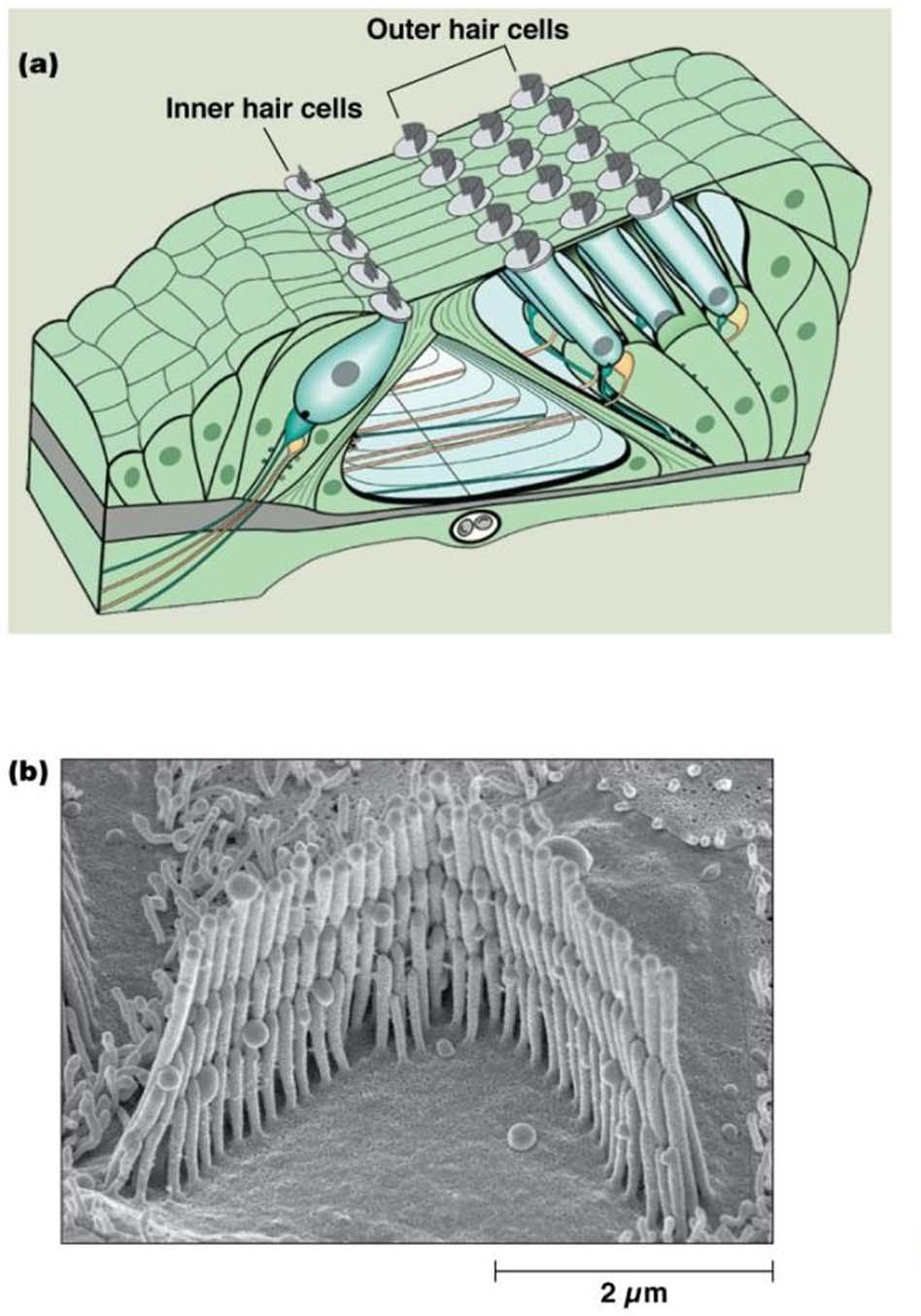 Hair cells in the inner ear containing stereocilia Myosin VII Stereocilia with actin bundles and myosins Genetic