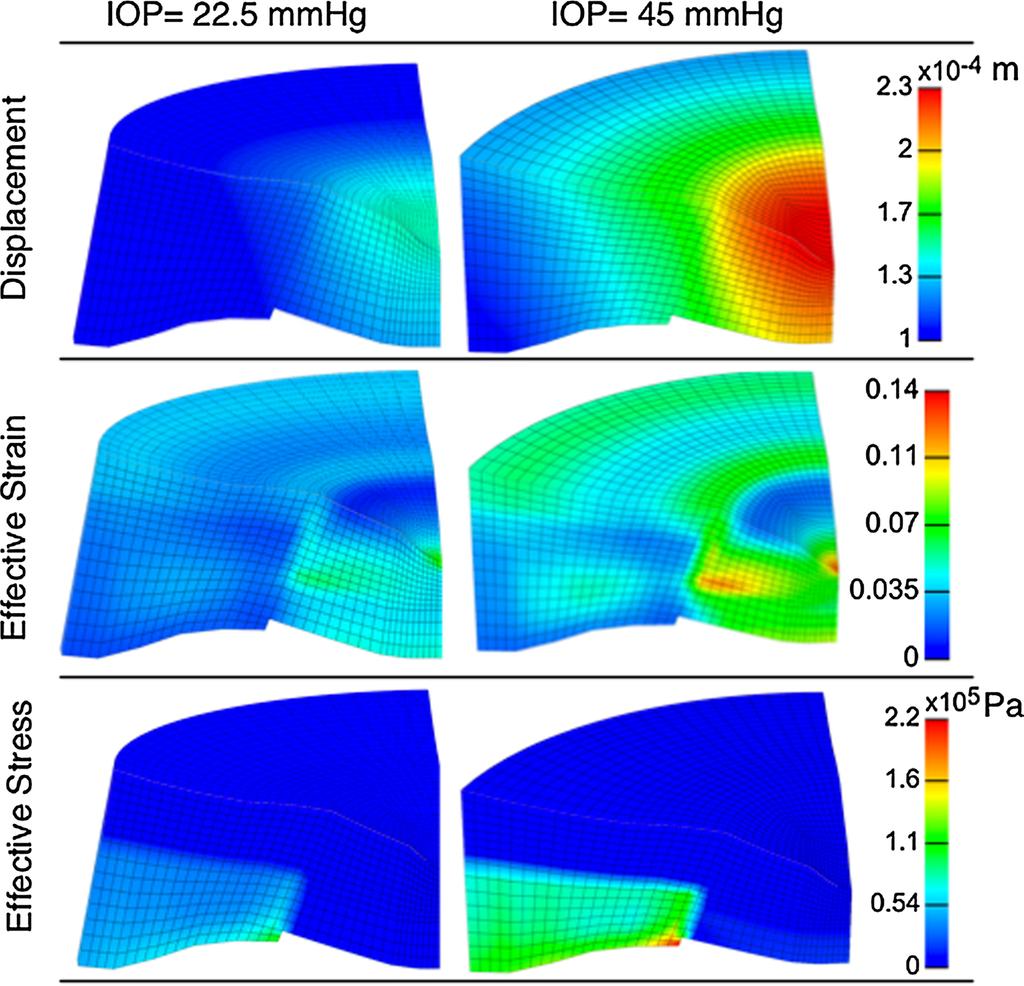L. Zhang et al. Fig. 4 Simulation results of the FE model for two IOP increases.