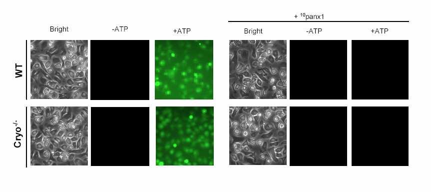 Role of Pannexin-1 in ATP-induced P2X7-mediated large pore formation