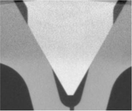 Figure 5-2 X-ray tomography image of