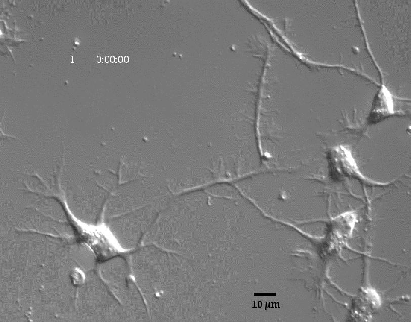 Cultured rat hippocampal neurons