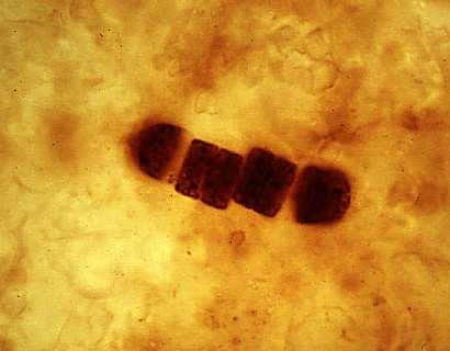 Picture of fossilized cyanobacteria. 3.