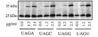 The tetranucleotide UGAC shows the most