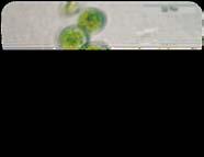Cycle of Snow Algae With 2 Phases In Spring (Growth &