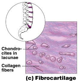 Connective Tissue Types Fibrocartilage Highly compressible Example: