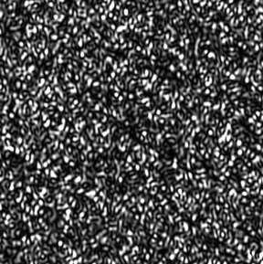 34 Speckle Effect Generation of speckles: Coherent light is refracted / reflected at a rough surface Roughness creates phase differences Interference of all partial waves: granulation, signature for