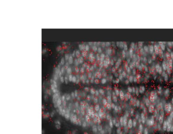 Intact Mouse Neural Tube Sections () Shh