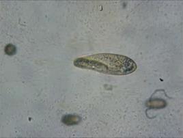 Examples: Paramecium: a group of