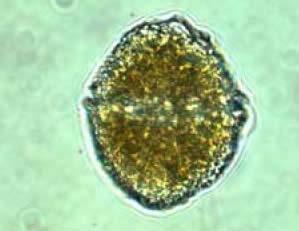 phytoplankton, sometimes at levels potentially lethal to humans or