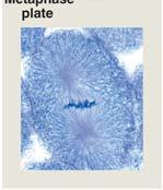 the metaphase plate Each chromatid attached to
