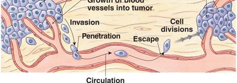 neoplasm formation Cancer: unchecked cell division In a benign tumor the cells usually remain within an