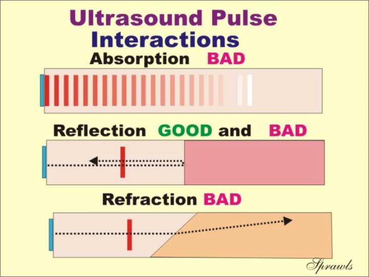 Interactions of Ultrasound with Matter Ultrasound pulse interacts with tissues