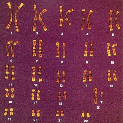 Genes contain DNA & are located on chromosomes in each