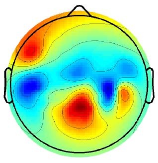 MEG/EEG Source Localization?