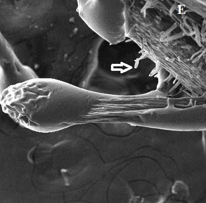 Fig.1. SEM study A) Dead Tetragonula iridipennis between the trichomes of P.