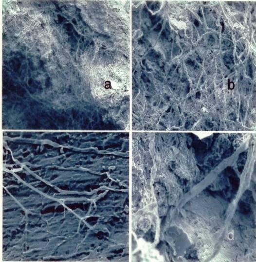 The influence of heterogeneity derived from clay fragments in a sandy soil matrix Colonization of lignite fragments by roots and mycorrhizal hyphae Penetration of lignite fragments