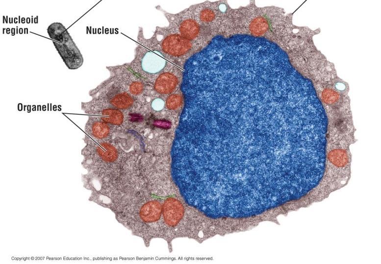 in a membrane-bound region) Complex Membrane bound organelles Organelle a