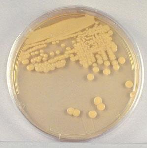 Growth on Agar Growth on solid surface Isolated growth Allows isolation of single colonies Allows isolation of pure cultures Single colony Solid Media (Cont d) Slants