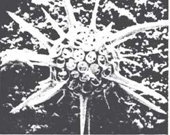 Image A radiolarian light under microscope Figure 1 Image B radiolarian under electron microscope Image A is described as blurred and image B is described as sharp.