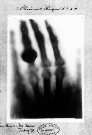 The Production of xrays X-rays were discovered in 1895 by German physicist Wihelm k. Roentgen. (First Nobel Prize in Physics 1901.) First medical x-ray image (taken of Mrs. Roentgen s hand).