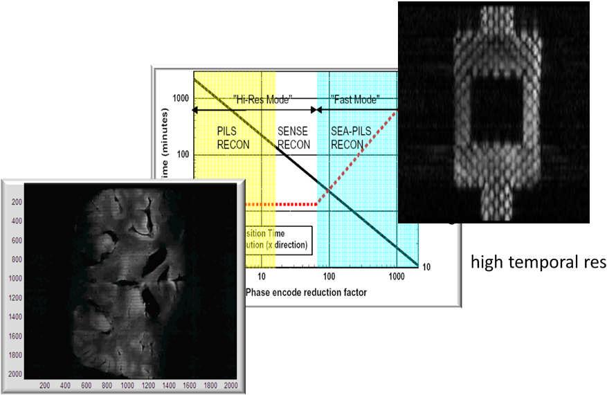 Fields & Parallel MRI quantitative