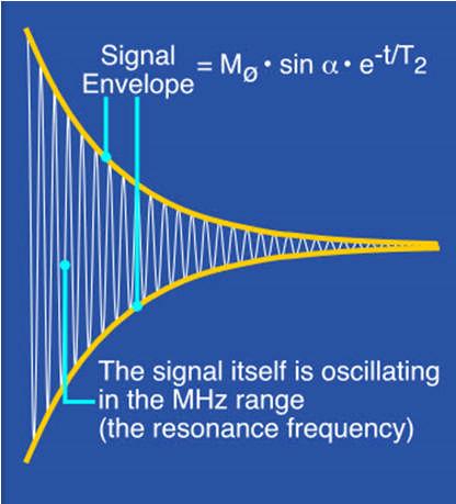 Relaxation the decay of the detectable signal Note: usually T2 is so much shorter than T1 that we consider the signal decay to