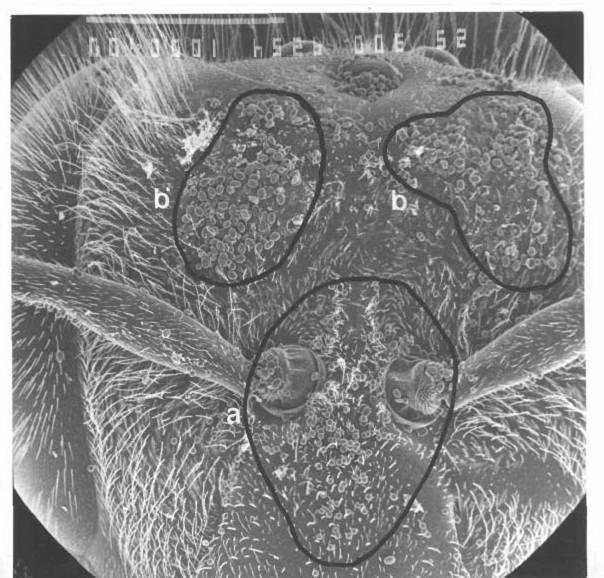 picture) Brassicaceae pollen Posterior of ventral