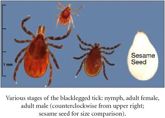 Deer Tick Lyme Disease