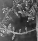 edu/~bruns/ Thelephoroid ectomycorrhiza On