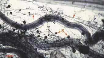 Mycorrhizal root system washed carefully from coarse sand to reveal the intact