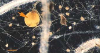 Soil hyphae produced by a single germinated spore of Gigaspora (arrow) used to start a mycorrhizal association.