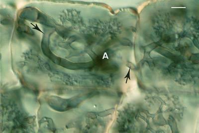 Colony of a VAM fungus spreading from the entry point (E) by convoluted hyphae (arrows) in the cortex of an Erythronium americanum root.