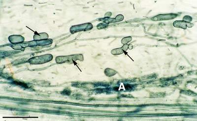This root also contains many intercellular hyphae