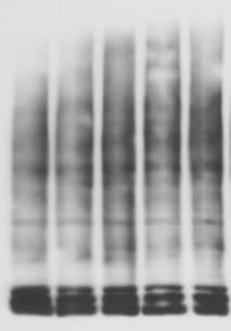 (b) Western blot of OPA1 oligomers and monomers from lysates of BMH crosslinking in live cortical neurons infected (for