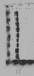 Supplementary Figure 17 cont.- Raw blots for supplementary figures Fig. S6a LC3 Fig.