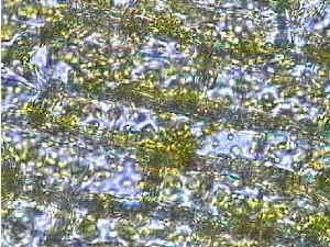 The photograph below is an elodea leaf X 400. Individual cells are clearly visible.