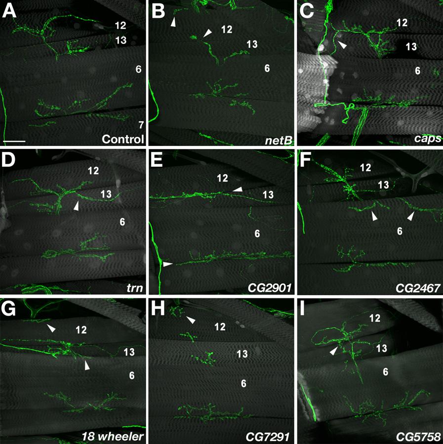 Figure 2. Examples of Mistargeting Phenotypes Confocal z-stack images of third-instar F1 larvae stained with 1D4 (green) and Alexa 488-phalloidin or anti-gfp (gray).