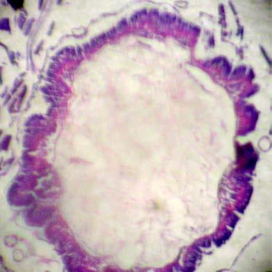 gut of the th instar larvae of
