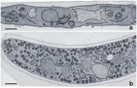 24 J. Li et al. Fig. 2.2 Transmission electron micrograph (TEM) of vegetative hypha (upper panel) and a trap cell. Bar, 1 mm. Note dense bodies only in the trap cell.