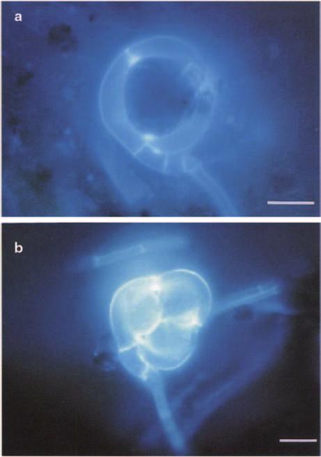 26 J. Li et al. Fig. 2.3 Constricting rings of Arthrobotrys dactyloides before (a) and after contraction (b). In (b) the captured nematode captured is just visible. Staining with calcofluor white.